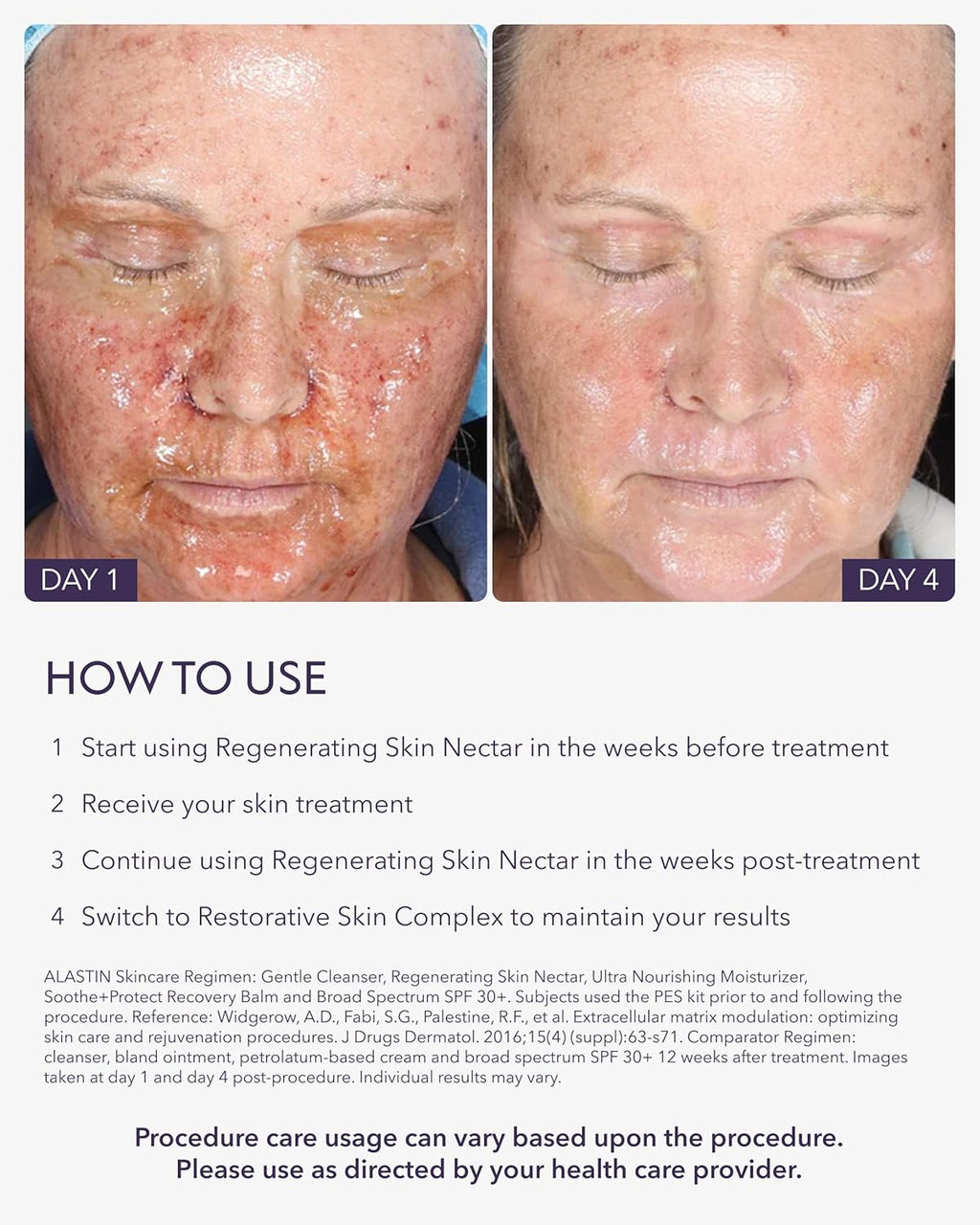 SkinCare Regenerating Skin Nectar Face Hydrating Moisturizer – 1 oz